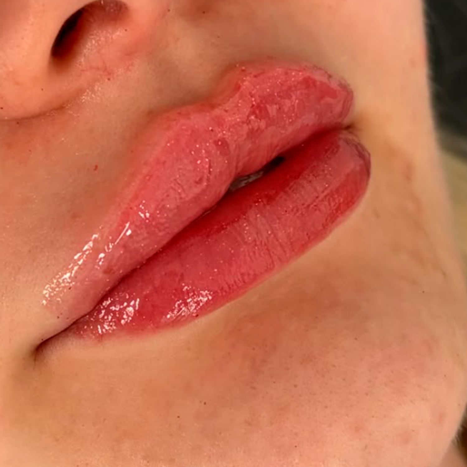After treatment result